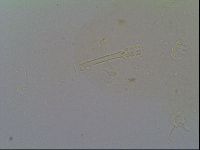Isohypsibius prosostomus image