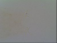 Isohypsibius prosostomus image