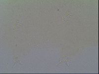 Isohypsibius prosostomus image