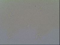 Isohypsibius prosostomus image