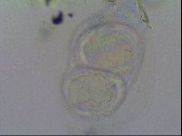 Thulinius saltursus image