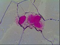 Thulinius saltursus image
