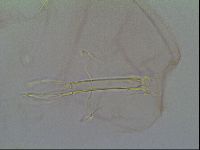 Thulinius saltursus image