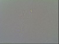 Thulinius saltursus image