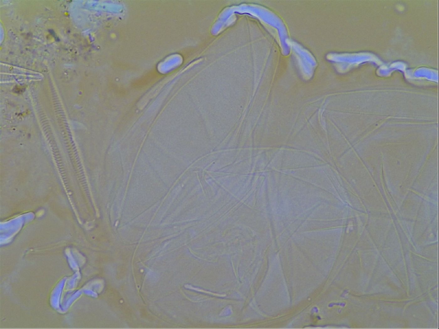 Thulinius saltursus image