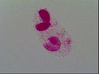 Thulinius saltursus image