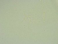Thulinius saltursus image