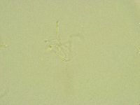 Thulinius saltursus image