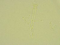 Thulinius saltursus image