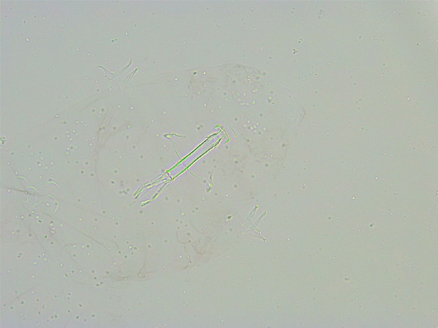 Thulinius saltursus image