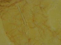 Thulinius saltursus image