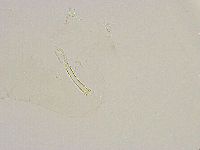 Thulinius saltursus image