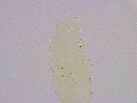 Thulinius saltursus image