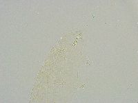 Isohypsibius reticulatus image