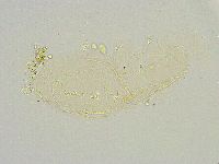 Isohypsibius reticulatus image