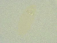 Isohypsibius sattleri image