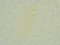 Isohypsibius sattleri image