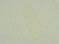 Isohypsibius sattleri image