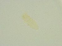 Isohypsibius sattleri image