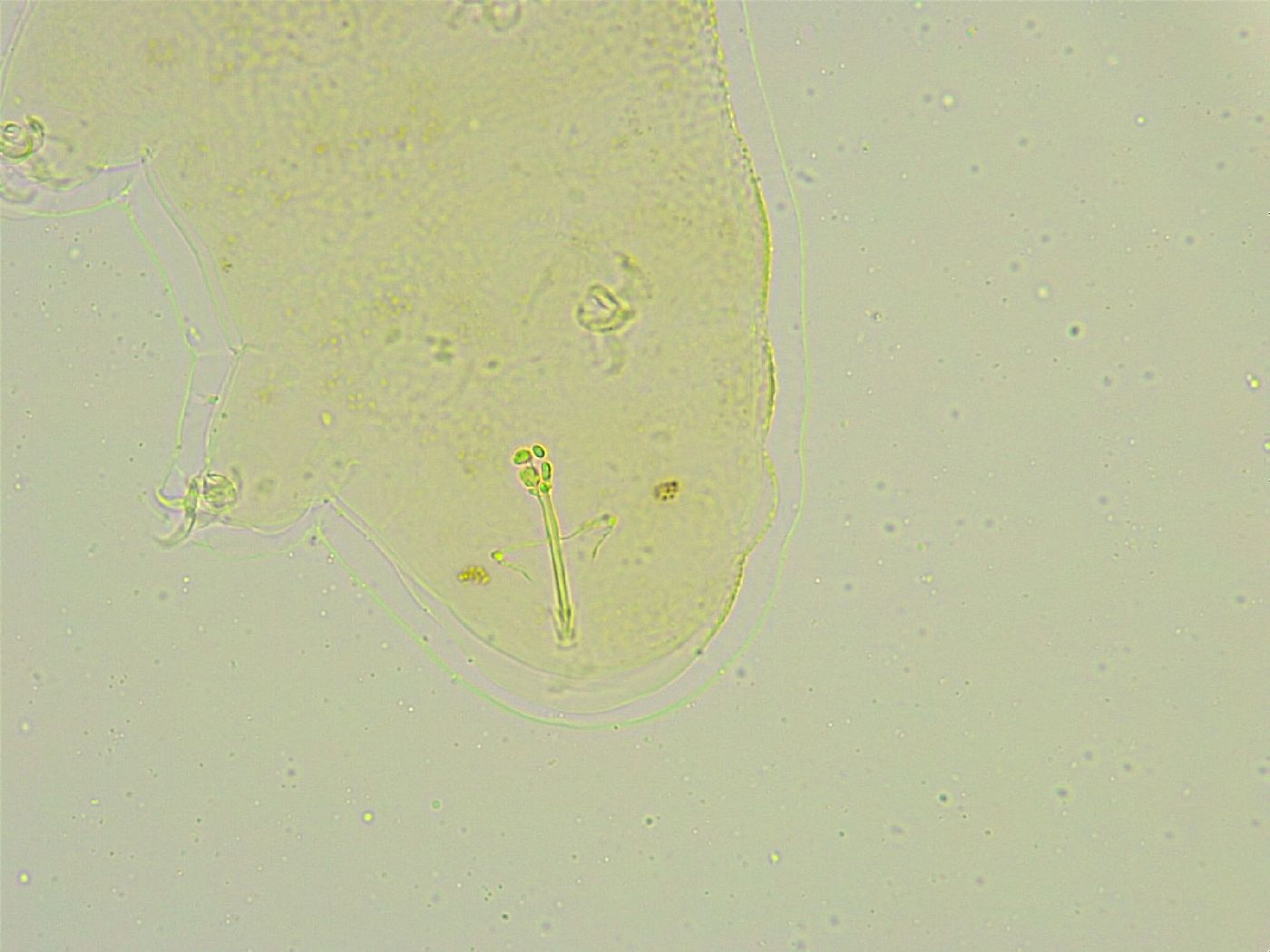 Isohypsibius tuberculatus image