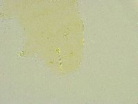 Isohypsibius tuberculatus image