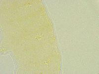Isohypsibius tuberculatus image
