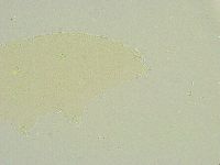 Isohypsibius tuberculatus image