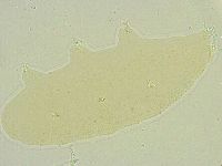 Isohypsibius tuberculatus image
