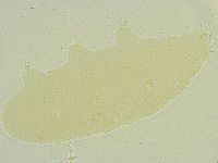 Isohypsibius tuberculatus image