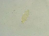 Isohypsibius tuberculatus image