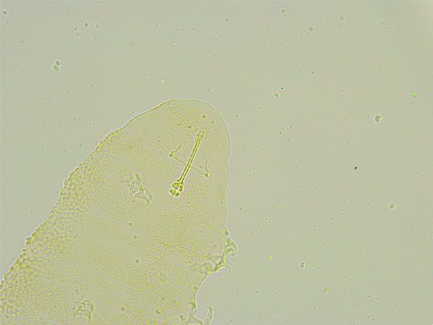 Isohypsibius tuberculatus image