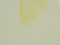 Isohypsibius tuberculatus image