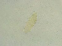 Isohypsibius tuberculatus image