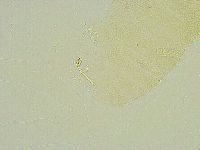Isohypsibius tuberculatus image