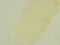 Isohypsibius tuberculatus image