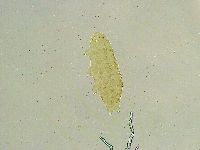 Isohypsibius tuberculatus image