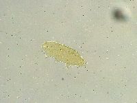Isohypsibius tuberculatus image