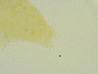 Isohypsibius tuberculatus image