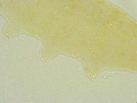 Isohypsibius tuberculatus image