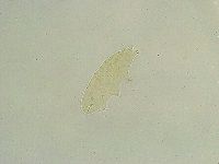 Isohypsibius tuberculatus image