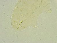 Isohypsibius tuberculatus image