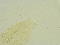 Isohypsibius tuberculatus image