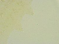 Isohypsibius tuberculatus image