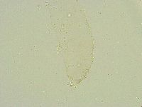 Isohypsibius wilsoni image