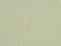 Isohypsibius wilsoni image