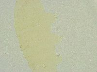 Isohypsibius wilsoni image