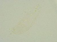 Isohypsibius wilsoni image