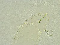 Isohypsibius wilsoni image