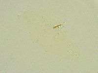 Isohypsibius wilsoni image
