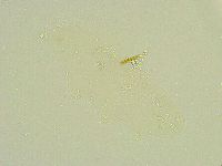 Isohypsibius wilsoni image